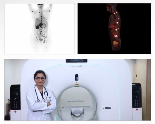 PET Scan cost in Rohtak